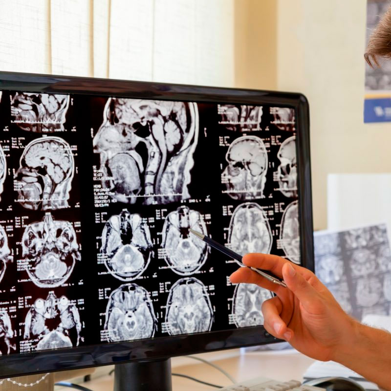 Neurologia